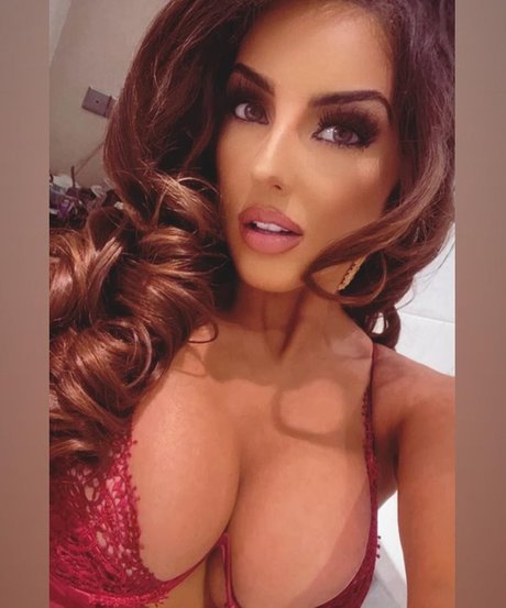 Misskayleighrosedematos