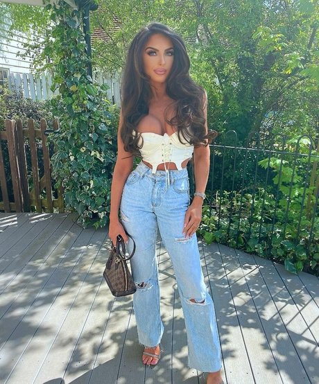 Misskayleighrosedematos