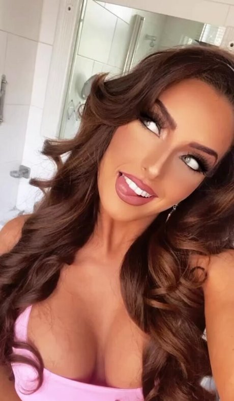 Misskayleighrosedematos