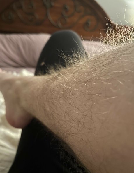 Hairy Women