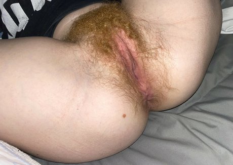 Hairy Women