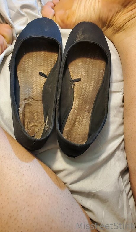 Missfeetstink