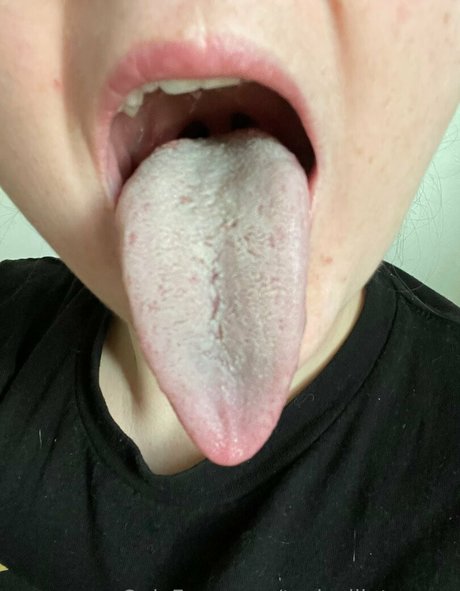 Toxicallietongue