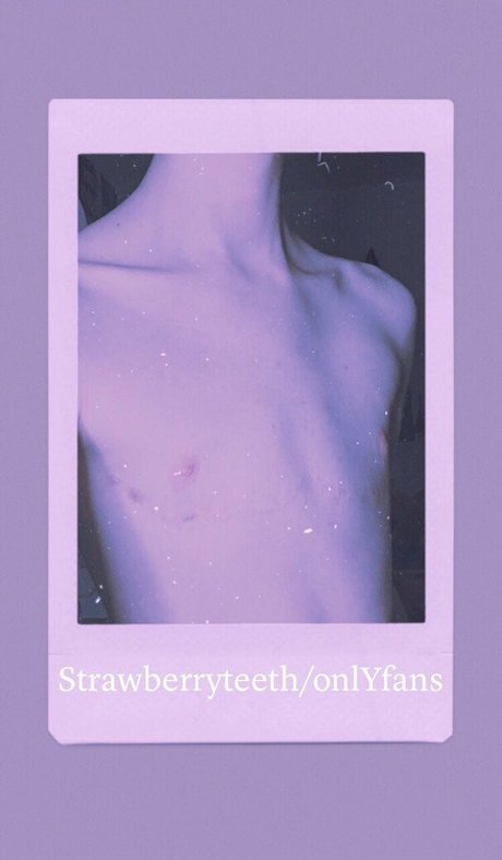 Strawberryteeth